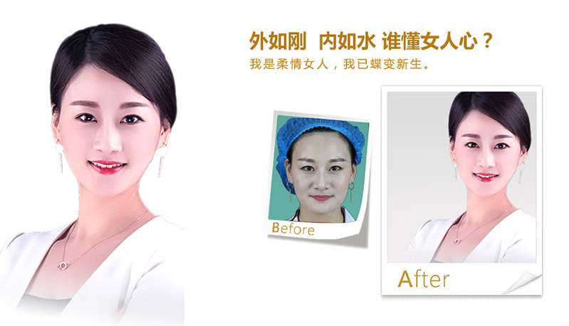 河源V脸、线雕隆鼻